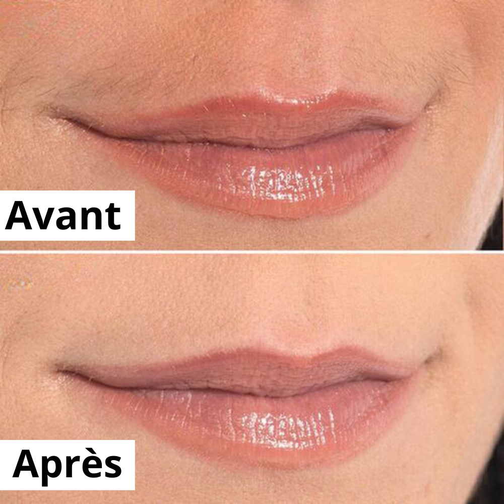 Flawly - L'épilateur facial